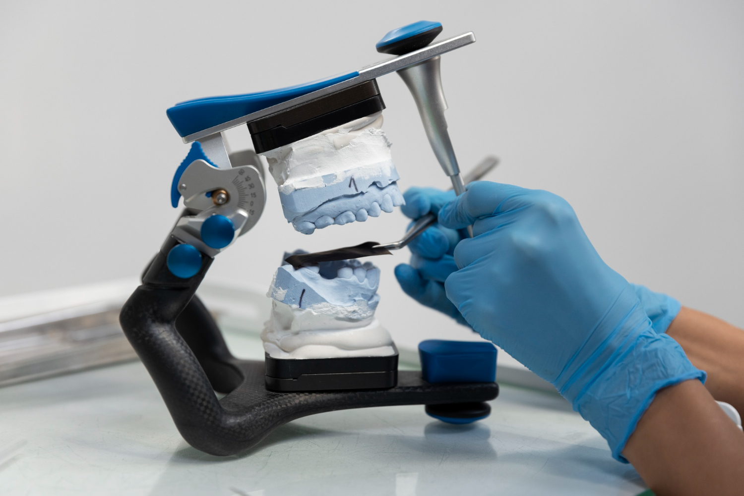 Las nuevas innovaciones en prótesis dentales